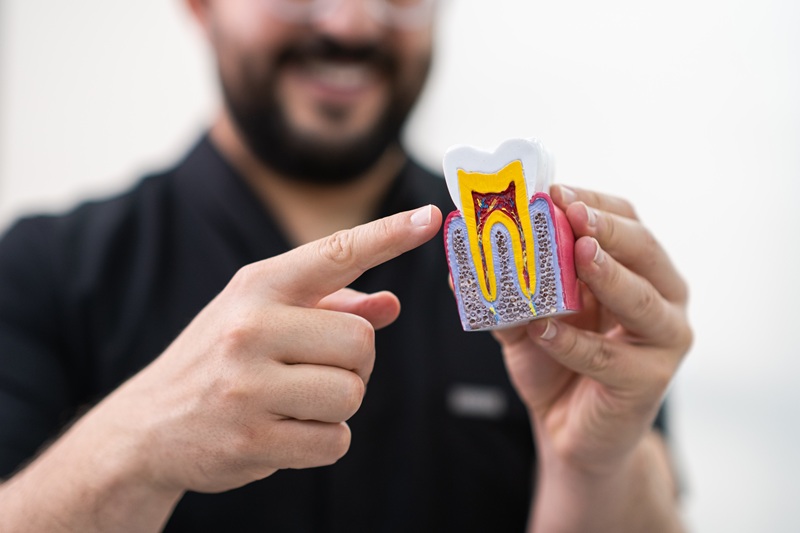 Stomatologist showing plastic model of human tooth with root canal