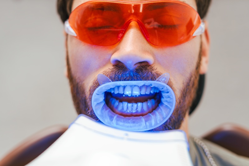 Handsome bearded man , patient whitening teeth in modern dental clinic. Teeth treatment, health care concept