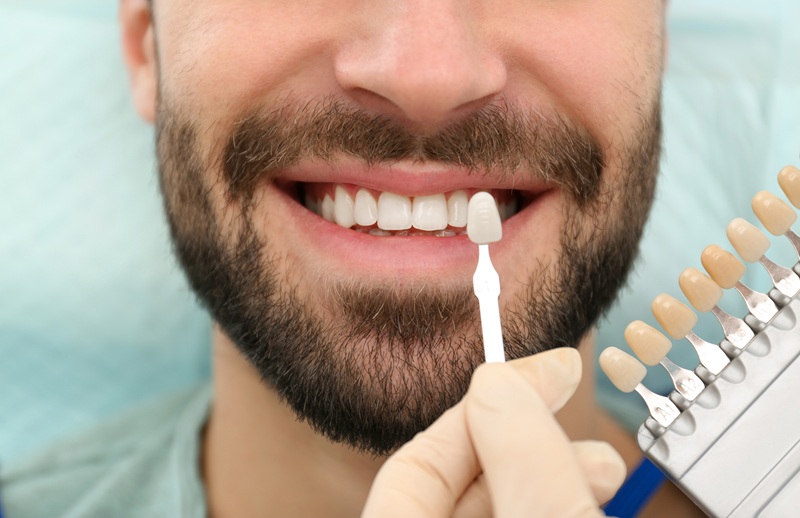 Dentist matching young man's teeth color with palette, closeup dental veneers
